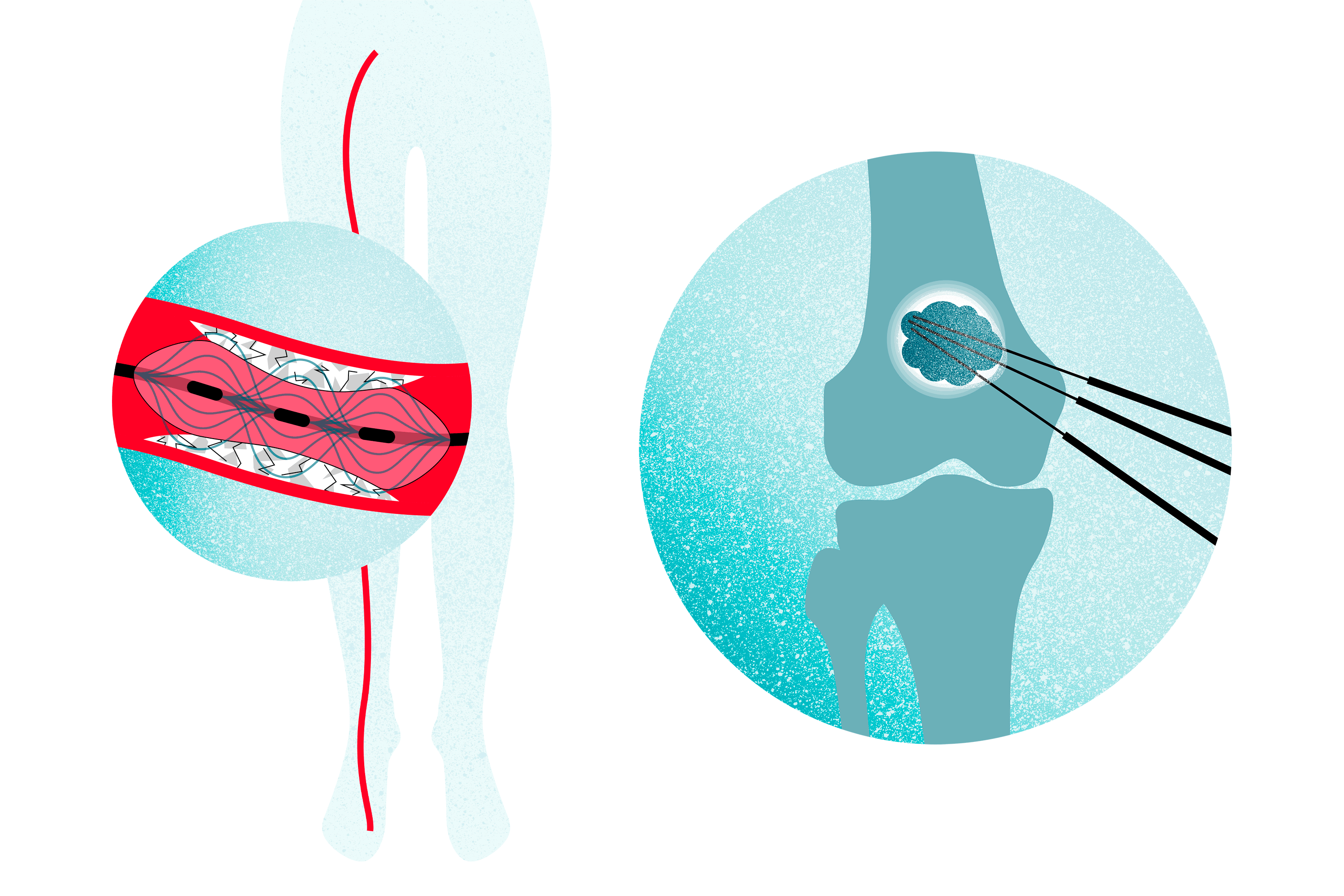 science_design-NR-CALCIO_BOREALIS